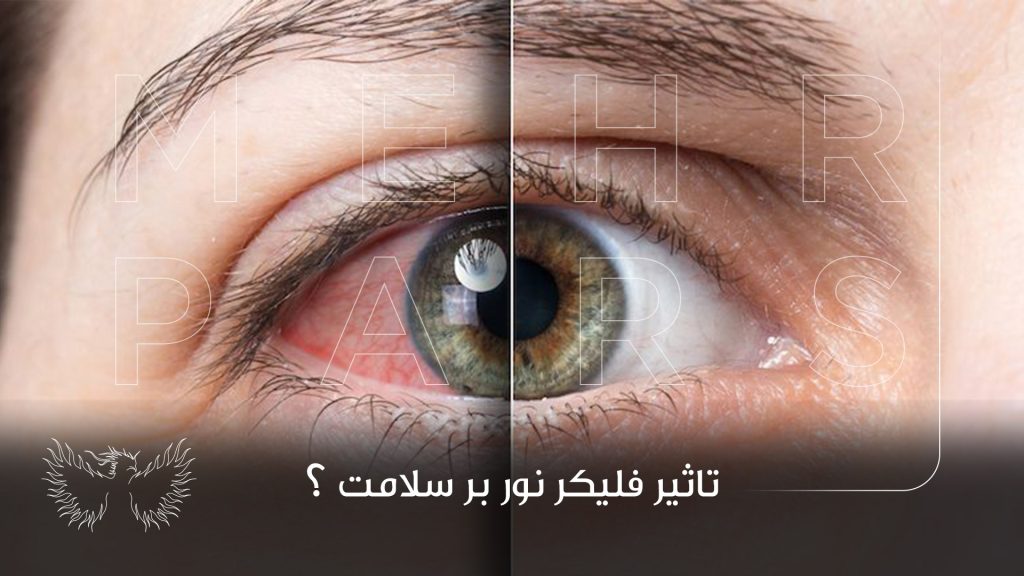 10 روش رفع مشکل چشمک زدن یا فلیکر نور (Flicker)
